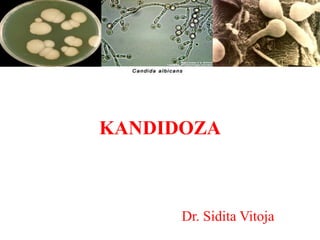 KANDIDOZA
Dr. Sidita Vitoja
 
