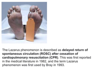 The Lazarus phenomenon is described as delayed return of
spontaneous circulation (ROSC) after cessation of
cardiopulmonary resuscitation (CPR). This was first reported
in the medical literature in 1982, and the term Lazarus
phenomenon was first used by Bray in 1993.
 