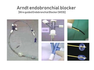 Arndt endobronchial blocker
[WireguidedEndobronchialBlocker(WEB)]
 