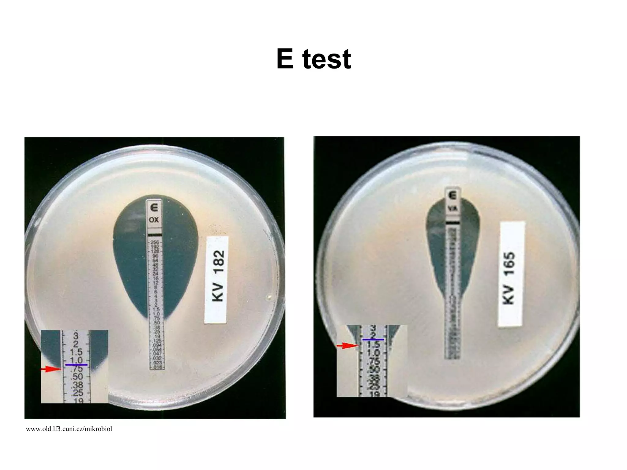 E test
www.old.lf3.cuni.cz/mikrobiol
 