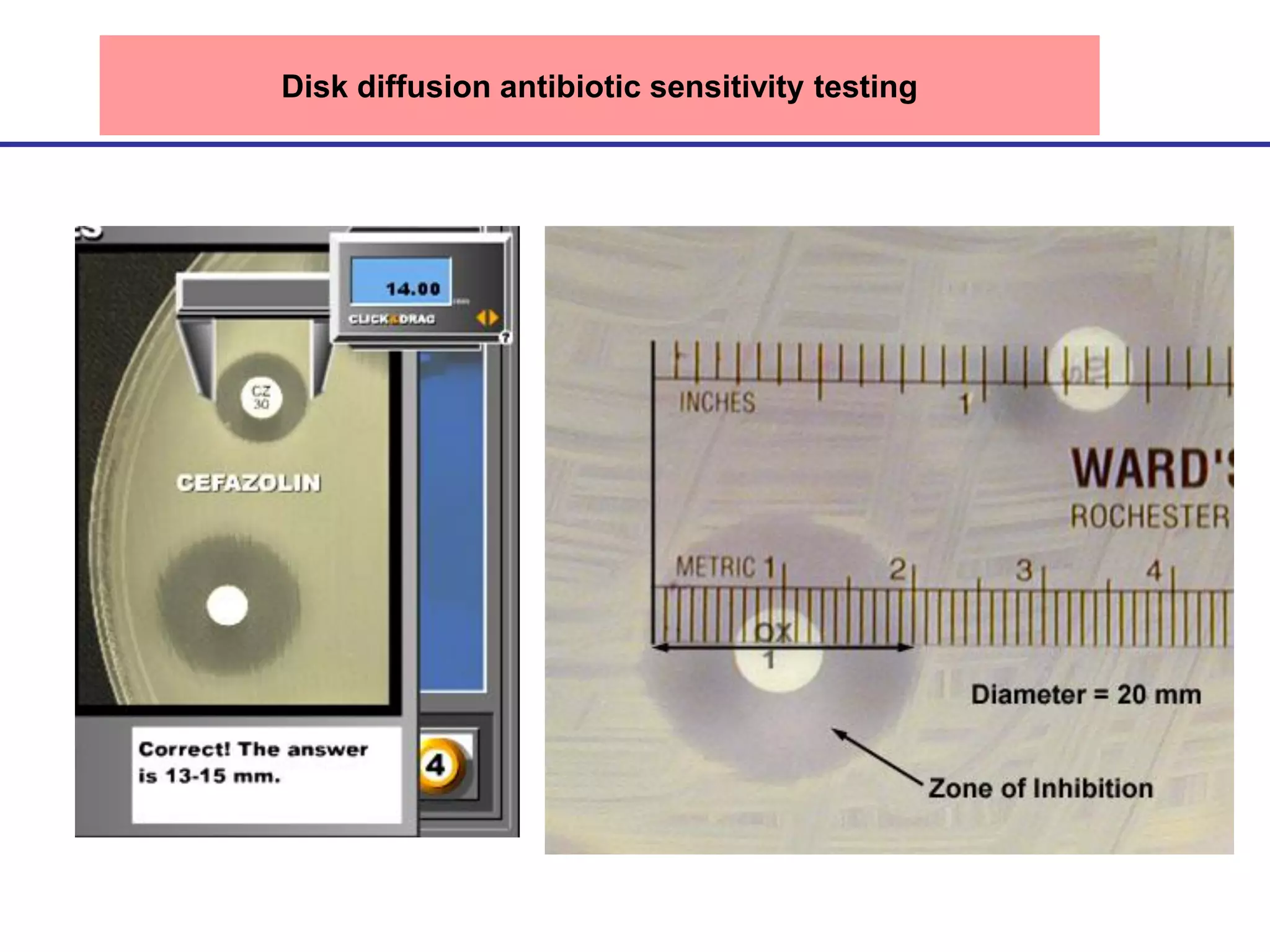Disk diffusion antibiotic sensitivity testing
www.old.lf3.cuni.cz/mikrobiologie
 