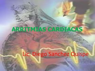 ARRITMIAS CARDIACAS
Lic. Diego Sanchez Quispe
 