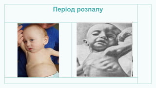 Період розпалу
 