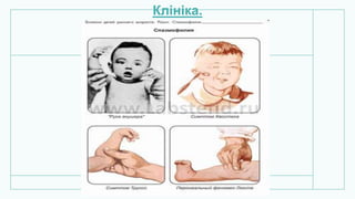 Клініка.
 