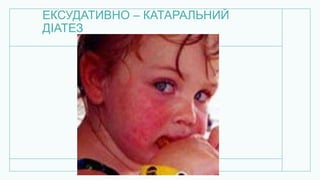 ЕКСУДАТИВНО – КАТАРАЛЬНИЙ
ДІАТЕЗ
 