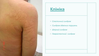 Клініка
• Спастичний синдром
• Синдром обмінних порушень
• Шкірний синдром
• Неврастенічний синдром
 