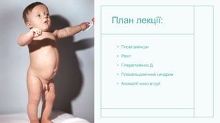 План лекції:
• Гіповітамінози
• Рахіт
• Гіпервітаміноз Д
• Гіпокальціємічний синдром
• Аномалії конституції
 