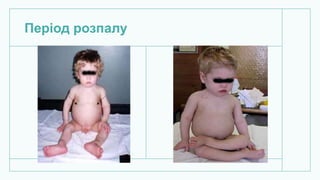 Період розпалу
 