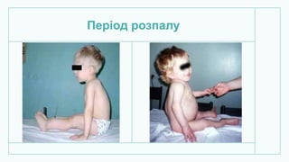 Період розпалу
 