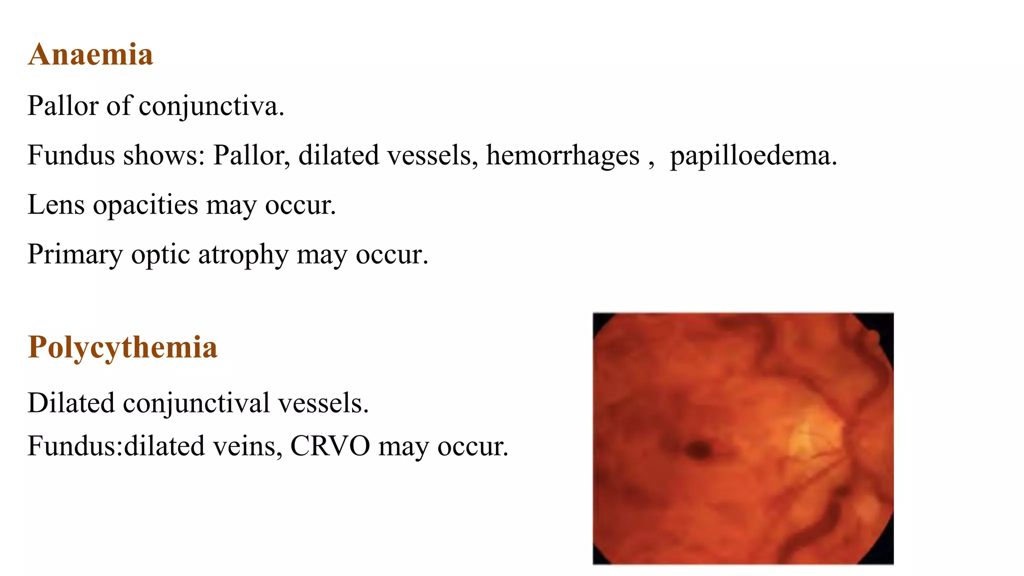 7. ocular, Systemic disease.pptx