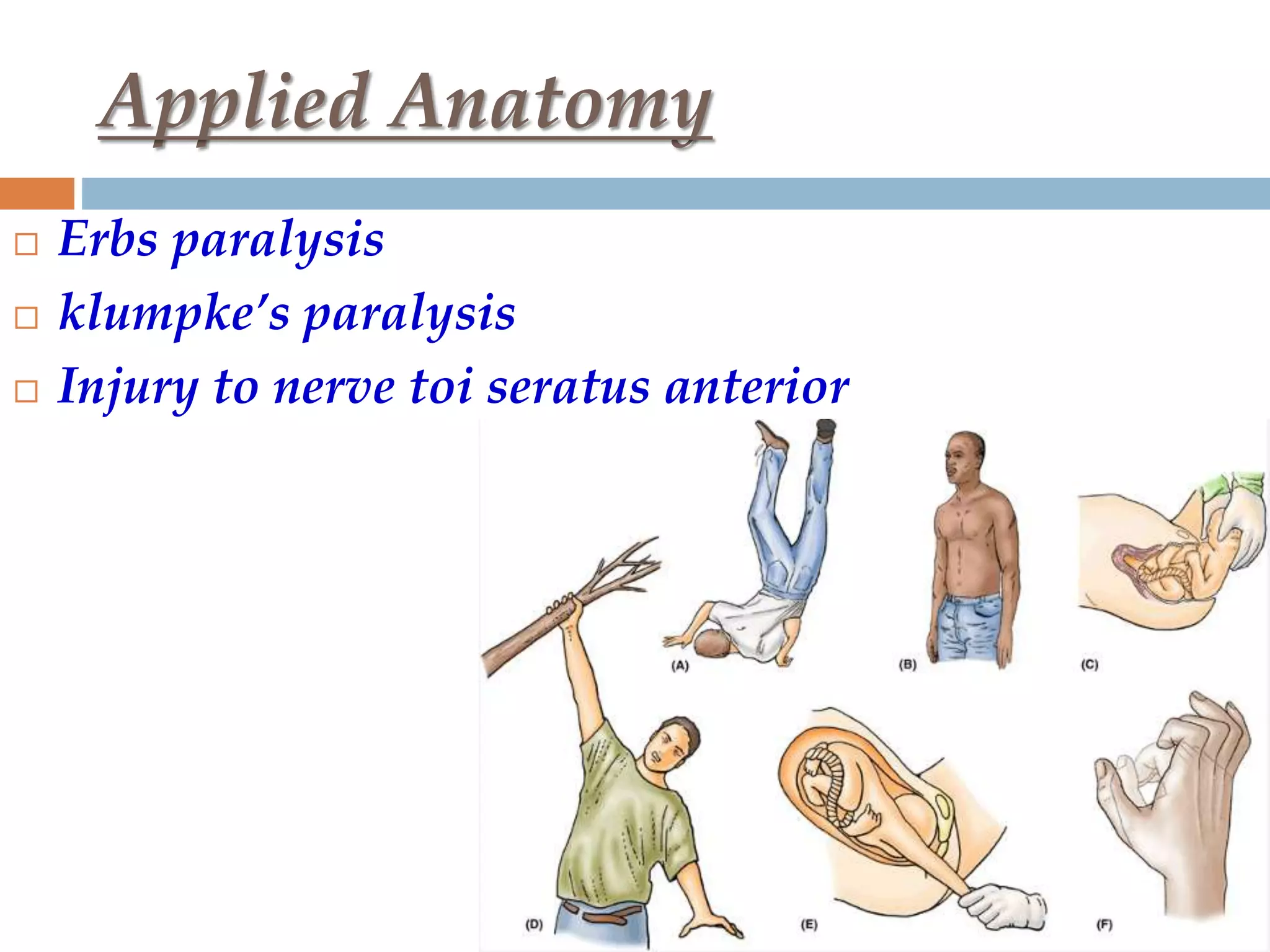 Applied Anatomy
 Erbs paralysis
 klumpke’s paralysis
 Injury to nerve toi seratus anterior
 