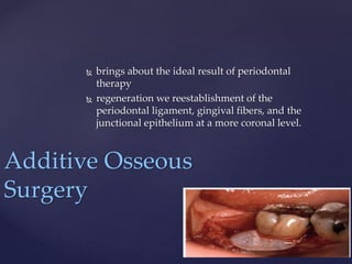  brings about the ideal result of periodontal
therapy
 regeneration we reestablishment of the
periodontal ligament, gingival fibers, and the
junctional epithelium at a more coronal level.
Additive Osseous
Surgery
 