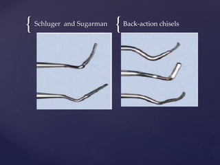 { {
Schluger and Sugarman Back-action chisels
 