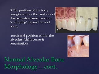 {
3.The position of the bony
margin mimics the contours of
the cementoenamel junction.
‘scalloping’ depend on root
form,
tooth and position within the
alveolus “dehiscense &
fenestration’
Normal Alveolar Bone
Morphology…cont..
 