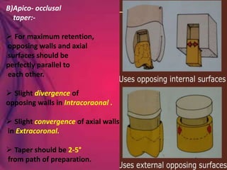 B)Apico- occlusal
taper:-
 For maximum retention,
opposing walls and axial
surfaces should be
perfectly parallel to
each other.
 Slight divergence of
opposing walls in Intracoraonal .
 Slight convergence of axial walls
in Extracoronal.
 Taper should be 2-5°
from path of preparation.
 