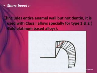 • Short bevel :-
Includes entire enamel wall but not dentin, it is
used with Class I alloys specially for type 1 & 2 (
Gold platinum based alloys).
 