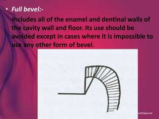 • Full bevel:-
Includes all of the enamel and dentinal walls of
the cavity wall and floor. Its use should be
avoided except in cases where it is impossible to
use any other form of bevel.
 