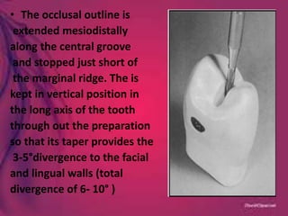 • The occlusal outline is
extended mesiodistally
along the central groove
and stopped just short of
the marginal ridge. The is
kept in vertical position in
the long axis of the tooth
through out the preparation
so that its taper provides the
3-5°divergence to the facial
and lingual walls (total
divergence of 6- 10° )
 
