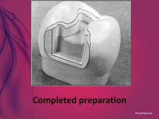 Completed preparation
 