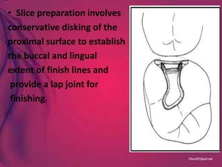• Slice preparation involves
conservative disking of the
proximal surface to establish
the buccal and lingual
extent of finish lines and
provide a lap joint for
finishing.
 