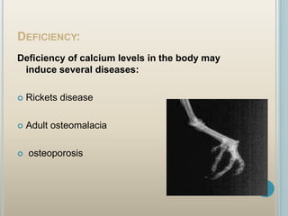 Calcium Difficiency Calcium metabolism disorders | PPT