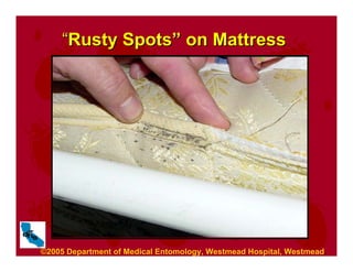 “
“Rusty Spots
Rusty Spots”
” on Mattress
on Mattress
©2005 Department of Medical Entomology, Westmead Hospital, Westmead.
 