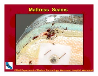Mattress Seams
Mattress Seams
©2005 Department of Medical Entomology, Westmead Hospital, Westmead.
 