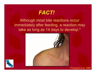 FACT!
Although most bite reactions occur
immediately after feeding, a reaction may
take as long as 14 days to develop.*
* Feingold et al. 1968
 