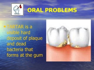 ORAL PROBLEMS
•TARTAR is a
visible hard
deposit of plaque
and dead
bacteria that
forms at the gum
 