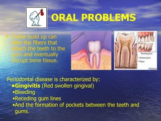ORAL PROBLEMS
• Tartar build up can
alter the fibers that
attach the teeth to the
gum and eventually
disrupt bone tissue.
Periodontal disease is characterized by:
•Gingivitis (Red swollen gingival)
•Bleeding
•Receding gum lines
•And the formation of pockets between the teeth and
gums.
 