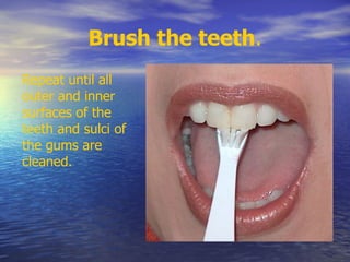 Brush the teeth.
Repeat until all
outer and inner
surfaces of the
teeth and sulci of
the gums are
cleaned.
 