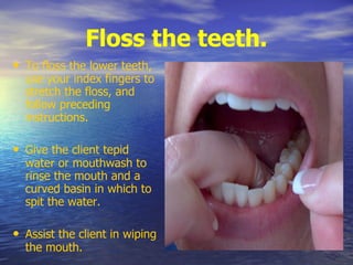 Floss the teeth.
• To floss the lower teeth,
use your index fingers to
stretch the floss, and
follow preceding
instructions.
• Give the client tepid
water or mouthwash to
rinse the mouth and a
curved basin in which to
spit the water.
• Assist the client in wiping
the mouth.
 