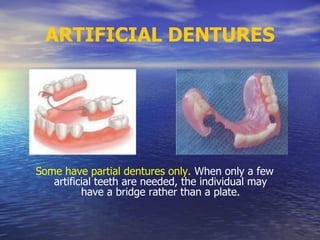 ARTIFICIAL DENTURES
Some have partial dentures only. When only a few
artificial teeth are needed, the individual may
have a bridge rather than a plate.
 