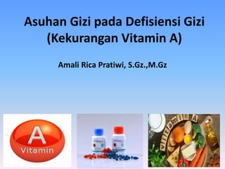 Asuhan Gizi pada Defisiensi Gizi
(Kekurangan Vitamin A)
Amali Rica Pratiwi, S.Gz.,M.Gz
 