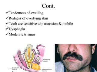 Tenderness of swelling
Redness of overlying skin
Teeth are sensitive to percussion & mobile
Dysphagia
Moderate trismus
50
Cont.
12/19/2023
 