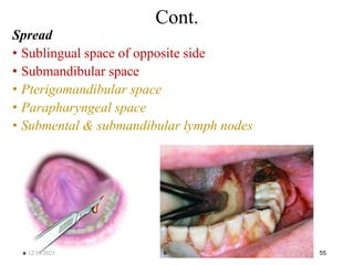 Spread
• Sublingual space of opposite side
• Submandibular space
• Pterigomandibular space
• Parapharyngeal space
• Submental & submandibular lymph nodes
55
Cont.
12/19/2023
 