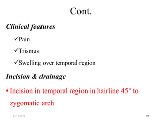Clinical features
Pain
Trismus
Swelling over temporal region
Incision & drainage
• Incision in temporal region in hairline 45 to
zygomatic arch
70
Cont.
12/19/2023
 