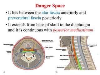Danger Space
• It lies between the alar fascia anteriorly and
prevertebral fascia posteriorly
• It extends from base of skull to the diaphragm
and it is continuous with posterior mediastinum
78
12/19/2023
 