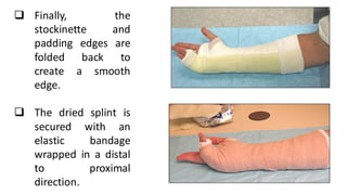 ❑ Finally, the
stockinette and
padding edges are
folded back to
create a smooth
edge.
❑ The dried splint is
secured with an
elastic bandage
wrapped in a distal
to proximal
direction.
 