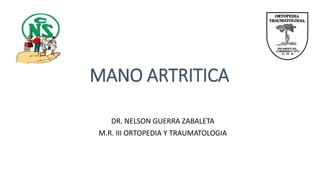 MANO ARTRITICA
DR. NELSON GUERRA ZABALETA
M.R. III ORTOPEDIA Y TRAUMATOLOGIA
 