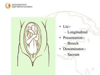 • Lie:-
– Longitudinal
• Presentation:-
– Breech
• Denominator:-
– Sacrum
 
