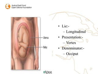 • Lie:-
– Longitudinal
• Presentation:-
– Vertex
• Denominator:-
– Occiput
 