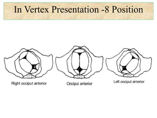In Vertex Presentation -8 Position
 