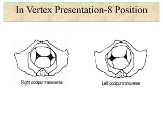In Vertex Presentation-8 Position
 