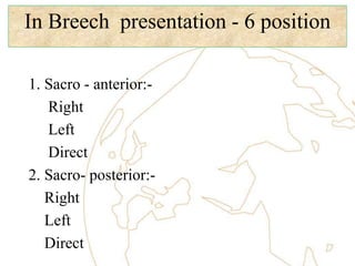 In Breech presentation - 6 position
1. Sacro - anterior:-
Right
Left
Direct
2. Sacro- posterior:-
Right
Left
Direct
 