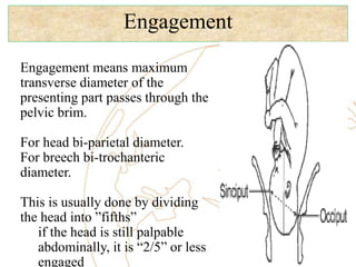 Engagement
Engagement means maximum
transverse diameter of the
presenting part passes through the
pelvic brim.
For head bi-parietal diameter.
For breech bi-trochanteric
diameter.
This is usually done by dividing
the head into ”fifths”
if the head is still palpable
abdominally, it is “2/5” or less
engaged
 