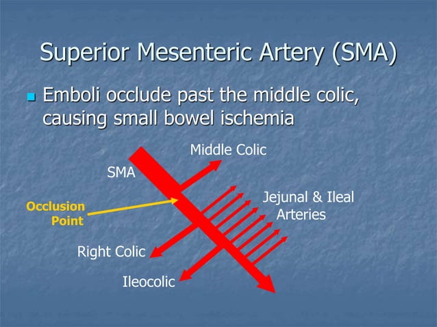 Medical Information Mesenteric Ischemia.ppt