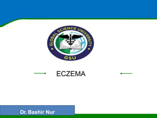 ECZEMA
Dr. Bashir Nur
 