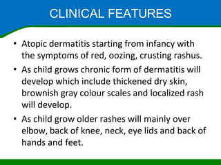 7. Eczema.pptxhhhhhhhhhhhhhhhhhhhhhhhhhhh | PPTX
