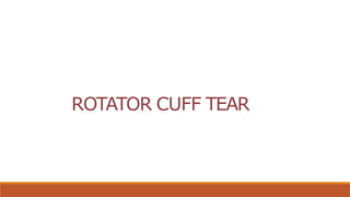 ROTATOR CUFF TEAR
 